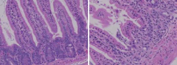 The left is a healthy mouse gut, and the right is a mouse gut that is malformed because it has insufficient ceramides