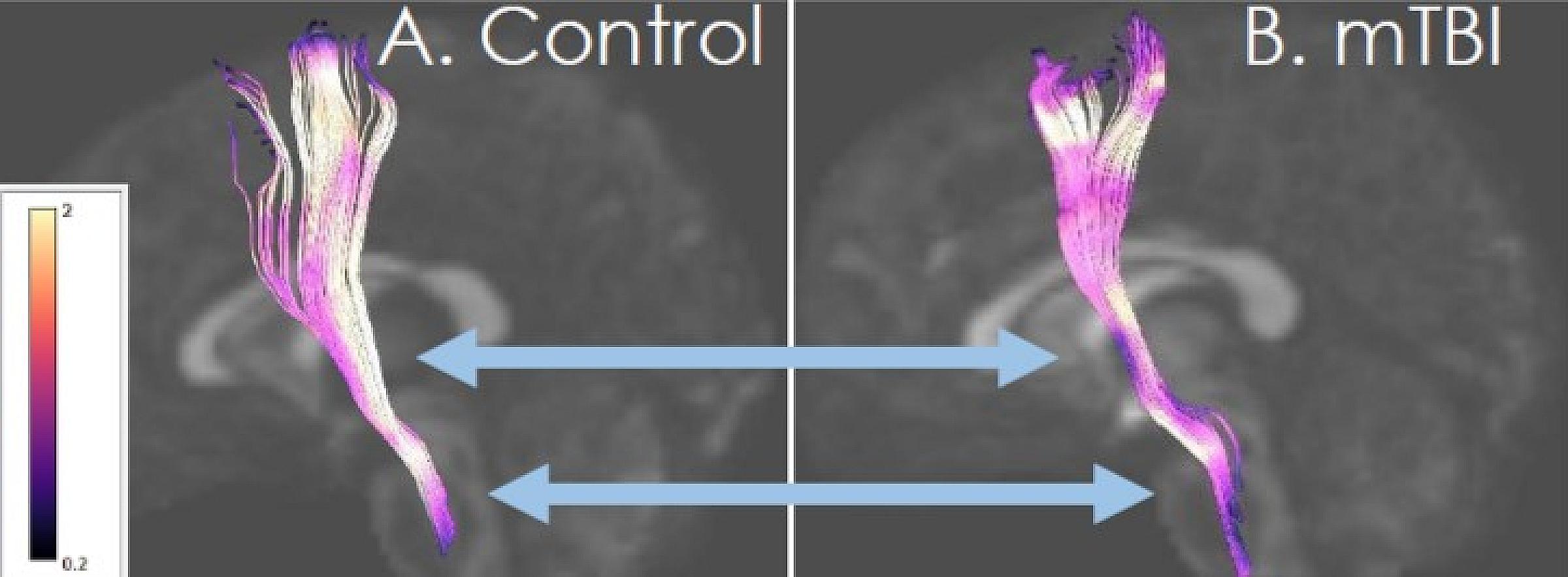 Brainstem control