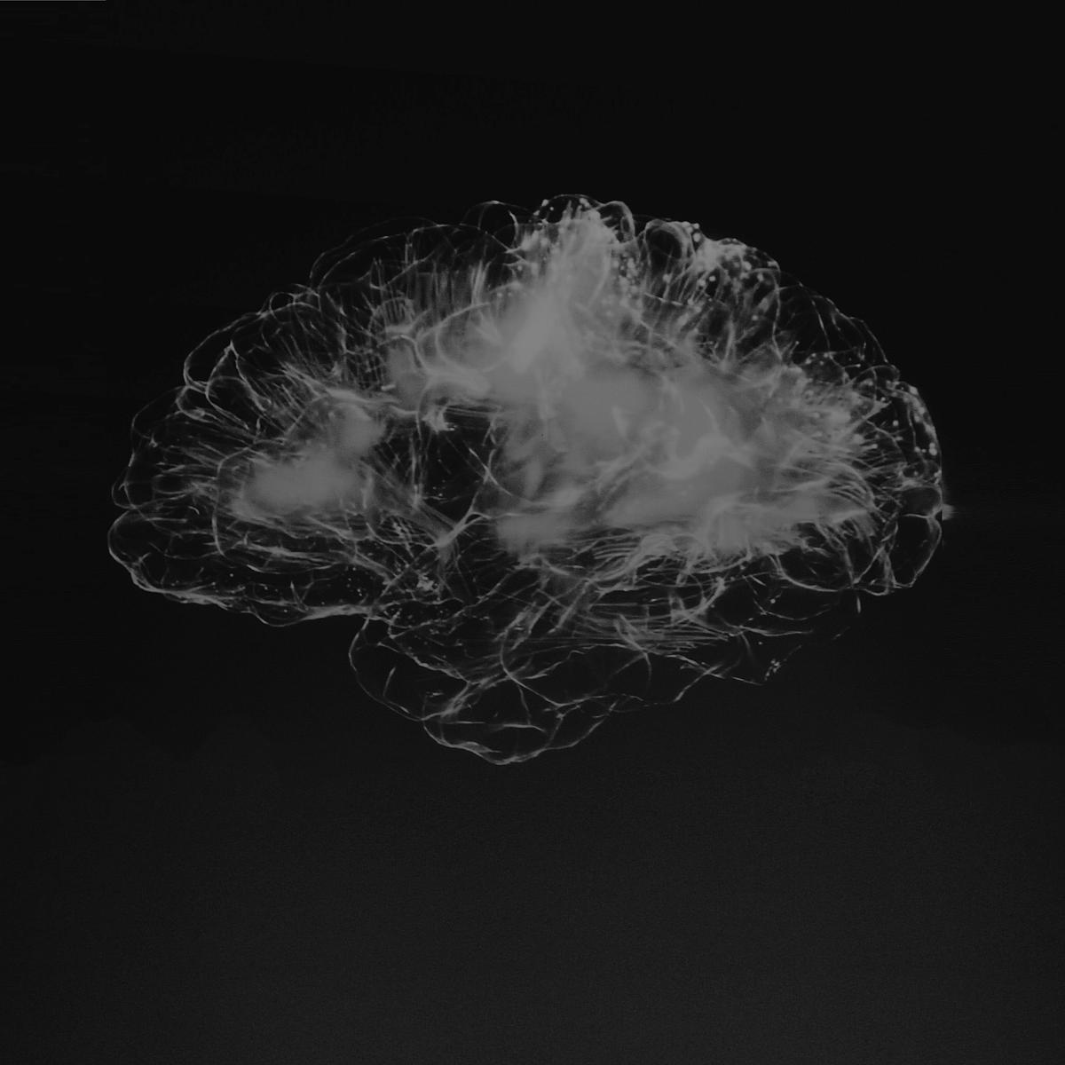 Model of neurologic system
